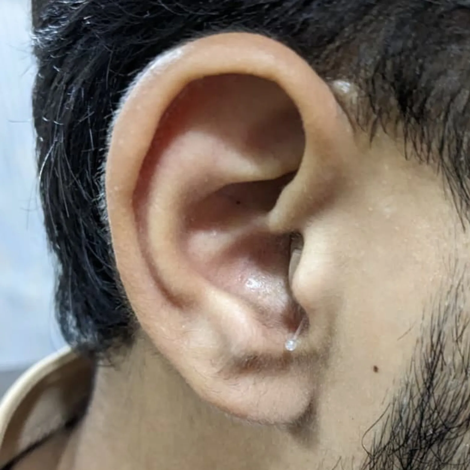 iic hearing aid